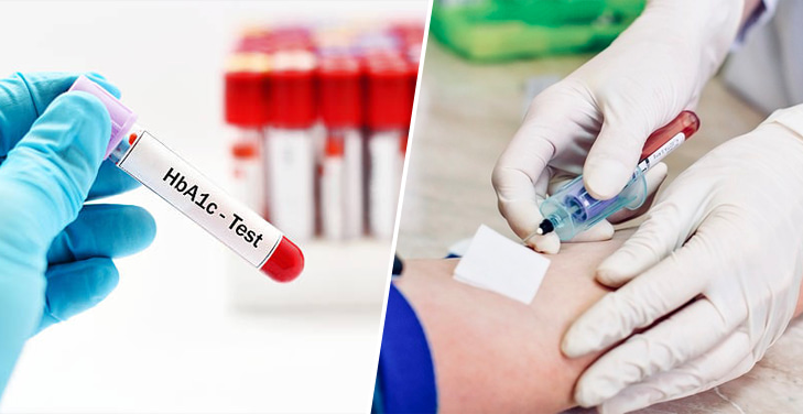 Hemoglobin-A1c-(HbA1c)-test