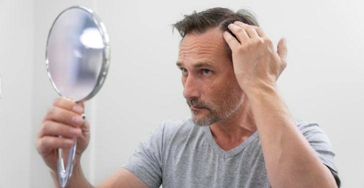 How-to-Stop-Hair-Loss-from-Diabetes