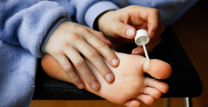 salicylic-acid-for-warts salicylic-acid-for-warts