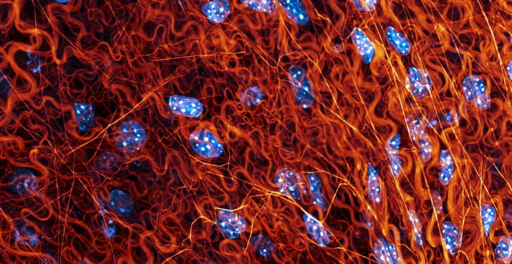 what-is-the-extracellular-matrix-of-connective-tissue-composed-of