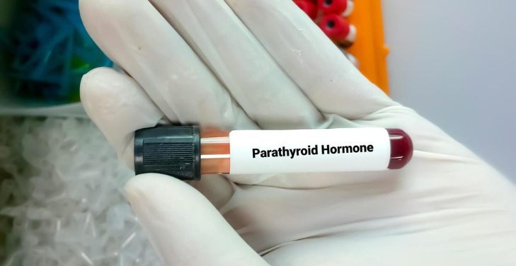 parathyroid-hormone-intact