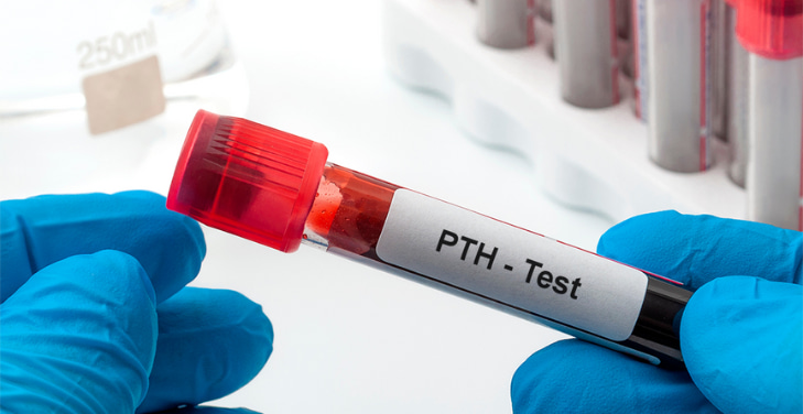 pth-blood-test