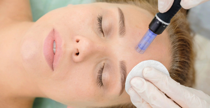 microneedling-pros-and-cons microneedling-pros-and-cons