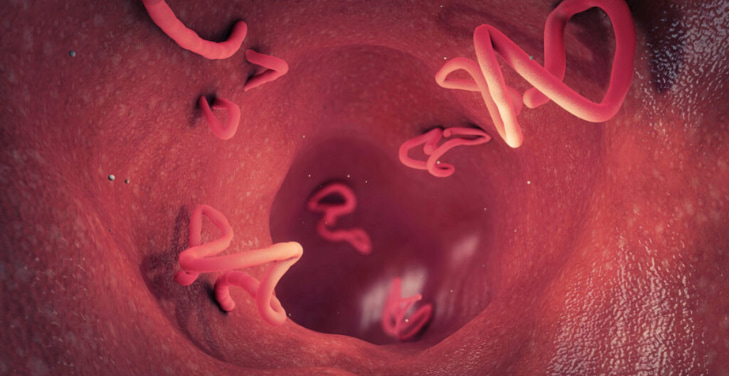 dangers-of-parasite-cleansing