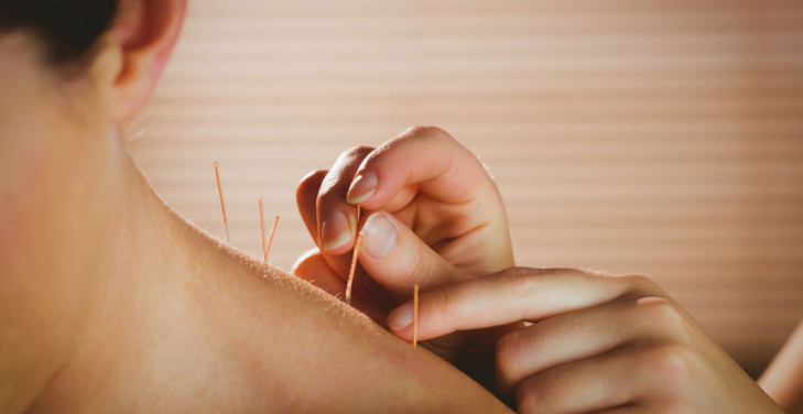 how-does-acupuncture-work-to-relieve-pain