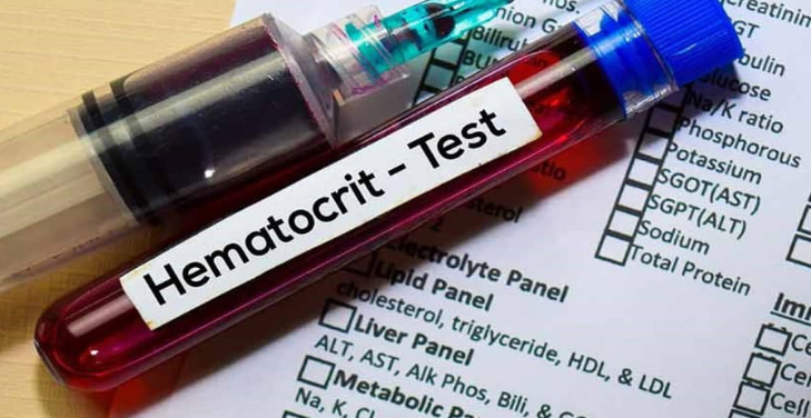 hematocrit-high-causes-in-women