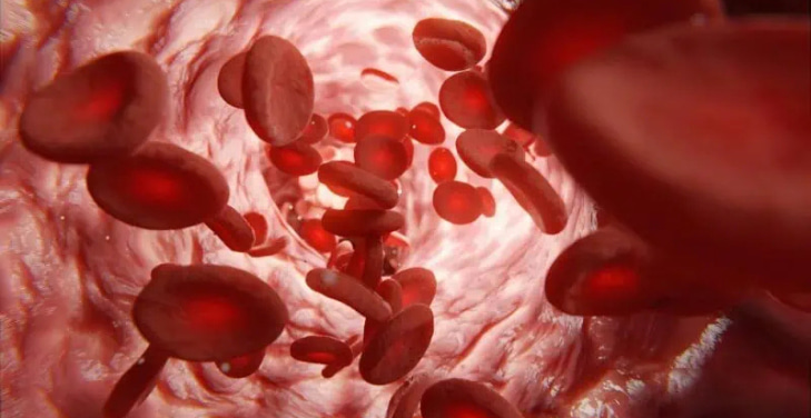 what-causes-high-iron-levels-in-blood