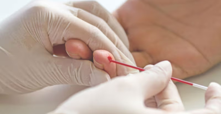what-is-hematocrit-in-a-blood-test